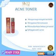 Acne Toner SR12 toner untuk kulit berminyak berjerawat